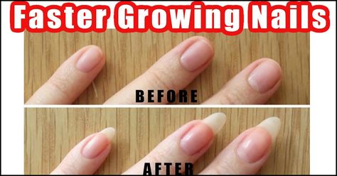 When it comes to taking care of your nails, getting a manicure is not the only option. In fact, you must take care of your nails on a daily basis. We have listed some easy nail care tips and tricks you can try at home to keep your nails clean and beautiful. Grow Long Nails, Nail Growth Tips, Grow Nails Faster, Natural Nail Care, Natural Nail Designs, Nail Care Tips, How To Grow Nails, Brittle Nails, Shiny Nails