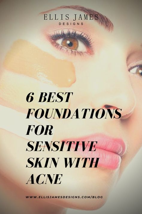 We are taking a closer look at sensitive skin with acne to learn how best to care for it and reveal the 6 best foundations for sensitive skin with acne. Read more at the Ellis James Designs Blog today! Best Foundation For Sensitive Skin, Best Foundation For Acne, Foundation For Sensitive Skin, Sensitive Acne Prone Skin, Allergy Season, Natural Makeup Tips, Acne Makeup, Best Foundations, Makeup Training