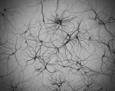 Love the complexity of this neuron network Regeneration Aesthetic, Networking Aesthetic, Mycelium Network, Neuroscience Art, Brain Neurons, Artificial Neural Network, Brain Art, Brain Cells, Outdoors Tattoo