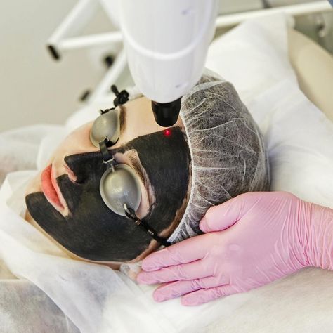 CosmeticPerks on Instagram: “Don't be scared! This carbon peel might look strange, but it's perfect for acne-prone skin types. A layer of liquid carbon is applied to…” Hollywood Peel, Carbon Peel, Laser Peel, Laser Facial, Vampire Facial, Skin Medica, Skin Imperfection, Led Light Therapy, Medical Spa