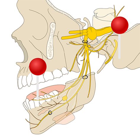 Illustrations and diagrams of the 12 pairs of cranial nerves | e-Anatomy Anatomical Drawings, Breast Image, Cranial Nerves, Medical Imaging, Cute Friend Pictures, Charles Darwin, Cute Friends, Nerve, Friend Pictures