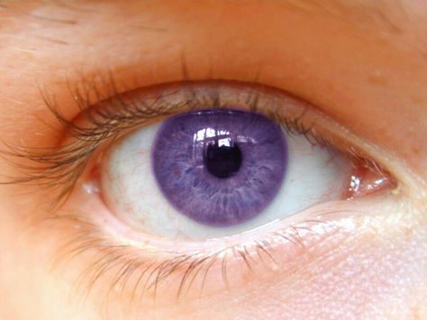 Light Purple Eye Rare Eye Colors, Steel Blue Eyes, Rare Eyes, Laser Eye Surgery, Beautiful Eyes Color, Eye Exercises, Eye Sight Improvement, Vision Eye, Violet Eyes