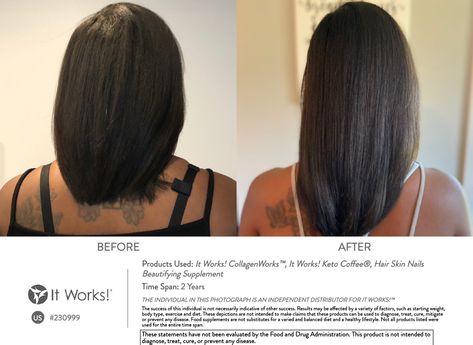 It works hair skin and nails, hsn, collagen before and after picture. Hair Growth Vitamins, Hair Skin And Nails, Vitamins For Hair Growth, Skin Nails, Nail Growth, Hair Vitamins, Hair Skin Nails, Before And After Pictures, Hair Skin