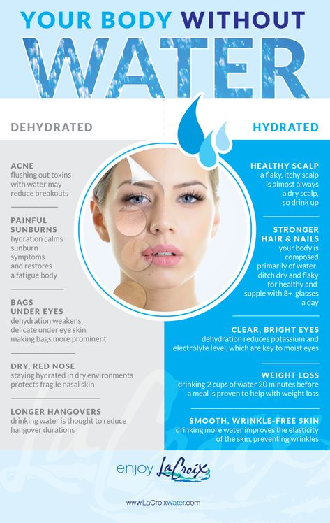 Your Body Without Water! Kangen Water Benefits, Hydrated Water, Water Business, Hydration Benefits, Benefits Of Water, Water For Health, Water Facts, Water Health Benefits, Water Quotes