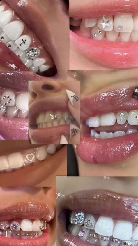 Grillz Aesthetic, Corporate Christmas Party, Teeth Gems, Pretty Teeth, Dental Jewelry, Grillz Teeth, Diamond Teeth, Braces Colors, Tooth Gems