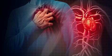 Acute Coronary Syndrome, Penyakit Jantung, Angina Pectoris, Gene Therapy, Heart Muscle, Coronary Arteries, Chest Pain, Cpr, Cardiovascular Disease