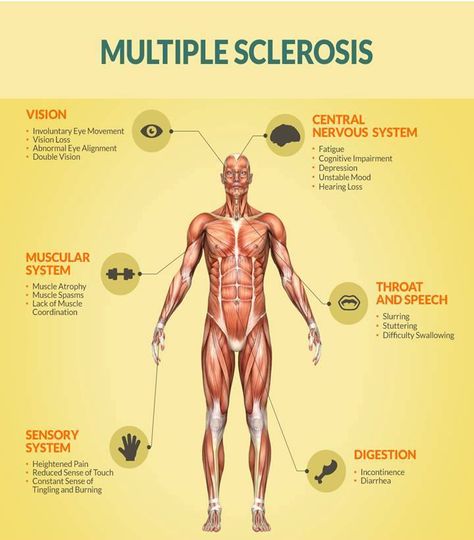 MULTIPLE SCLEROSIS has shown to affect African Americans later in life, as compared to the general population. And there's also 3 SURPRISING factors that contribute to Black America's RISK of MS. Find out (and protect yourself) here --->> Multiple Sclerosis Symptoms, Ms Project, Ms Symptoms, Muscle Atrophy, Ms Awareness, Multiple Sclerosis Awareness, Muscular System, Muscle Spasms, Neurological Disorders