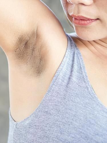 Do you feel embarrassed because you have darker skin under your arms? Fortunately, there are effective home remedies for black underarms, which you can do easily by yourself. Clean Underarms Dark Armpits, Underarm Cleaning, Black Underarms Remedies, Herbal Joints, Dark Armpit Remedies, Underarm Darkness Remedies, Underarm Darkness, Black Underarms, Rid Of Dark Underarms