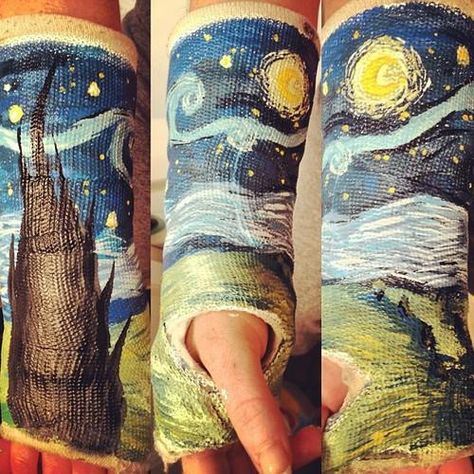 11 Awesomely Decorated Casts Worth a Broken Bone | Mental Floss Cassandra Calin, Cast Art, Behind Blue Eyes, The Starry Night, 웃긴 사진, Cool Stuff, Tumblr Posts, Tumblr Funny, Amazing Art