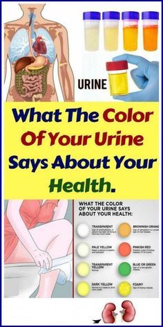 what the color of your urine ways about your health Preventative Health, Health Info, Health Advice, Health Facts, Herbal Remedies, Womens Health, The Body, Home Remedies, Health Benefits