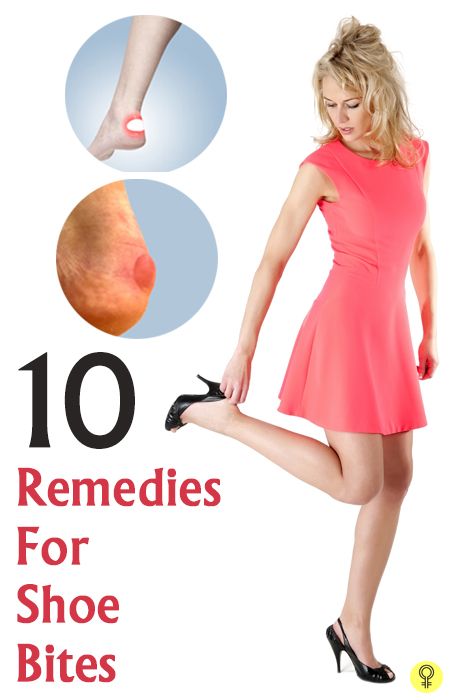 Top 10 Home Remedies For Shoe Bites : The initial happiness and joy soon goes away when you begin to develop shoe bites and resultant blisters. Shoe Bite Hacks, Blisters Remedies, Heel Hacks, Blister Remedies, How To Heal Blisters, Sagging Skin Remedies, Heel Blisters, Shoe Hacks, Top 10 Home Remedies