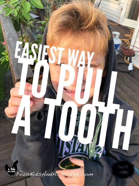 Watch the easiest way to pull a tooth. You won't believe how fast it its. How To Pull Out A Loose Tooth Kids, How To Pull Your Tooth Out, Loose Tooth Removal Kid, How To Pull A Tooth With No Pain Kids, How To Pull Out A Loose Tooth, Tooth Pain Relief, Waffle Sticks, Boys Be, Tooth Pulled