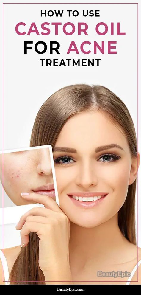 How to Use Castor oil for Acne? Use Of Castor Oil, Best Acne Scar Removal, Scalp Spa, Castor Oil For Acne, Castor Oil For Face, Oil Face Cleanser, Castor Oil Uses, How To Clear Pimples, Pure Castor Oil