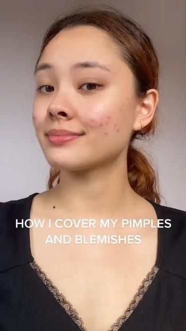 Cover pimple/blemishes with makeup routine How To Cover Pimples, Cover Pimples, Cover Up Pimples, Beauty And Cosmetics, Light Makeup Looks, Good Skin Tips, Makeup Artist Tips, Easy Makeup Tutorial, How To Do Makeup