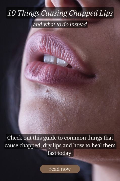 image of a person's lips and text that says"10 Things Causing Chapped Lips and what to do instead Check out this guide to common things that cause chapped, dry lips and how to heal them fast today! read now @ wellbeingbyjess.com" Chapped Lips Remedy, Cold Sore Relief, Remedies For Dry Mouth, Home Remedies For Warts, Oily Skin Remedy, Warts Remedy, Everyday Habits, Natural Remedies For Migraines, Sunburn Relief