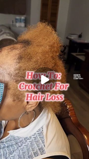 Crochet Braid Pattern For Alopecia, Braids For Alopecia For Black Women, Alopecia Braid Styles, Alopecia Hairstyles Black Women, Style For Hair, Braiding Techniques, Crochet Braid Pattern, Alopecia Hairstyles, Sew In Weave