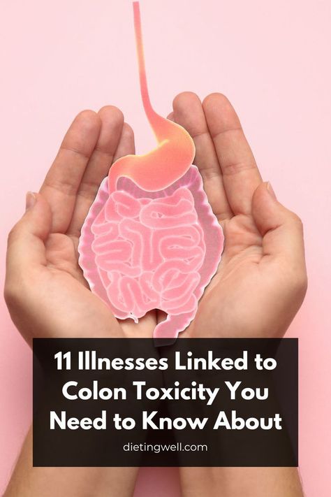 Learn about the surprising illnesses associated with colon toxicity and how they can affect your health. Discover preventive measures and treatments Low Fodmap Diet Plan, Fodmap Diet Plan, Vitamin Rich Foods, Fodmap Meal Plan, Clean Colon, Cleaning Your Colon, Acid Reflux Diet, Colon Detox, Colon Health