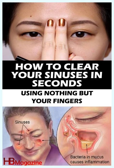 Sinus Blockage, Blocked Sinuses, How To Clear Sinuses, Cold Or Allergies, Sinus Congestion, Sinus Infection, Honeymoon Travel, Acupressure, Wellness Tips