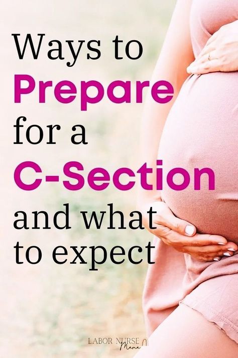 Ways you can be prepared for a C-Section and exactly what to expect from your surgery. The ultimate cesarian guide. C Section Preparation, Cesarian Section, Prepare For C Section, Birth Advice, Cool Calm And Collected, Stages Of Labor, Labor Nurse, Birth Labor, Labor Delivery