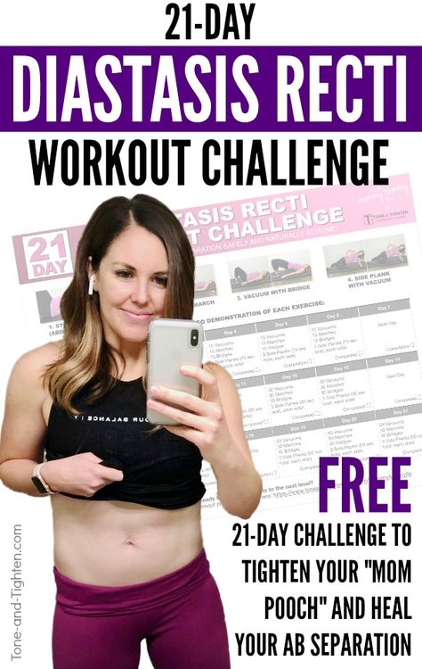 ALL-NEW - "21 Day Diastasis Recti Workout Challenge"! Join me for 21 days as I help with your diastasis recti ab rehab! Postpartum Workout Challenge, Diastasis Recti Challenge 21 Days, Fix Diastasis Recti 21 Days, Ab Rehab Exercises, Ab Rehab Post Pregnancy, Postpartum Ab Rehab, Workouts For Diastasis Recti, Ab Rehab, Postpartum Advice