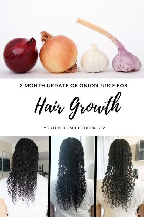 In this video, I share my onion juice for HAIR GROWTH & SHEDDING 2 month update. You will learn about my setbacks, and see the before and after photos of my hair growth. I'll also share how my hair shedding got better than worse! Onion Juice For Hair Growth, Juice For Hair Growth, Juice For Hair, Onion Hair Growth, Onion Juice For Hair, Onion For Hair, Onion Juice, Hair Mask For Growth, Hair Shedding