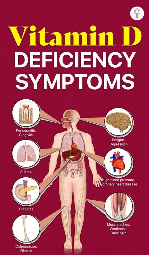 Vitamin D Deficiency Symptoms: Inadequate level of vitamin D in the body is responsible for causing vitamin D deficiency. With plenty of sunshine available, it is indeed surprising that deficiency of vitamin D is a worldwide problem. #vitaminD #deficiency #nutrition Vitamin D Deficiency Symptoms, Deficiency Symptoms, Calcium Deficiency, Iv Infusion, Vitamin B12 Deficiency, Food Health Benefits, Vitamin D Deficiency, Healthy Bones, Health Knowledge