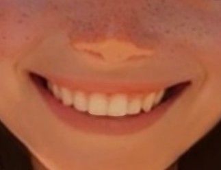 Perfect Teeth Aesthetic Korean, Sharp Canine Teeth Human Aesthetic, Teeth Claims For Dr Sharp, White Smile Aesthetic, Sharp Canines Human, Smile Claim For Dr, Teeth Claims For Dr, Canine Teeth Human Aesthetic, Teeth Claim