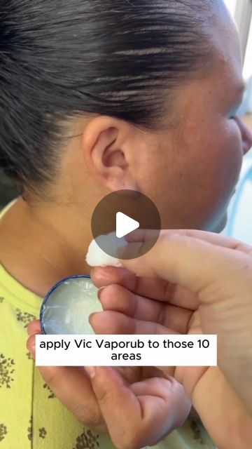 Vapor Rub Uses, Vic Vaporub, Earache Remedies, Vicks Vapor Rub, Vicks Vapor, Vicks Vaporub Uses, Uses For Vicks, Sinus Relief, Cough Suppressant