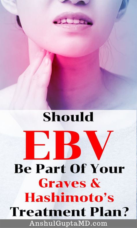 Ebv Reactivation, Ebv Virus, Low Thyroid Remedies, Virus Symptoms, Epstein Barr, Thyroid Remedies, Low Thyroid, Hashimotos Disease, Graves Disease