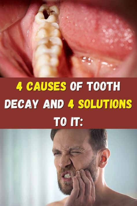 Grow Back Receding Gums, Fix Teeth, Tooth Decay Remedies, Remedies For Tooth Ache, Teeth Health, Tooth Pain, Stronger Teeth, Oral Care Routine, Receding Gums