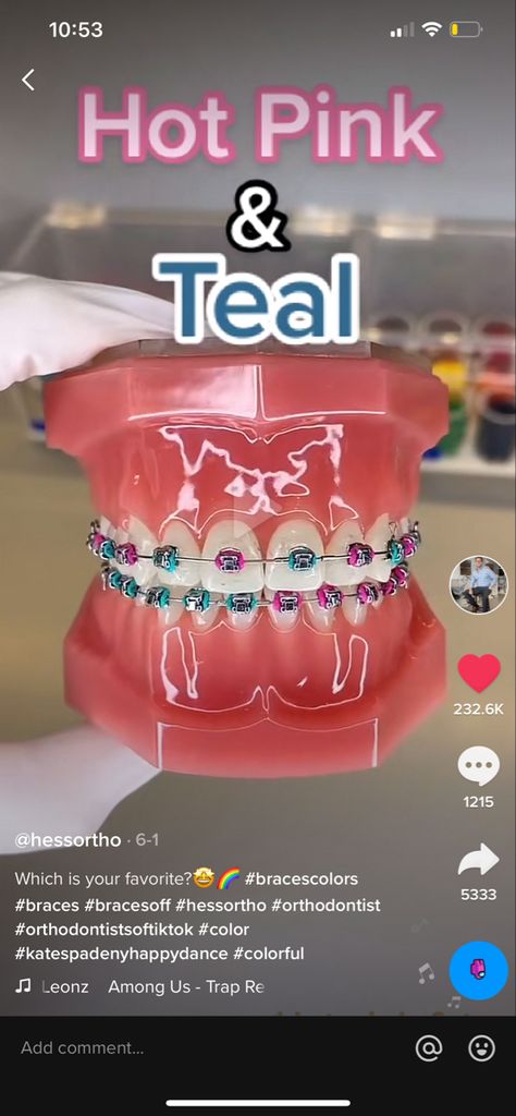 Cotton Candy Braces, Braces Color Combo Ideas, 2 Braces Colors Ideas, Neon Braces Colors, Teal And Pink Braces, Cute Braces Colors Combinations, August Braces Colors, Braces Combination Colors, Pink And Blue Braces