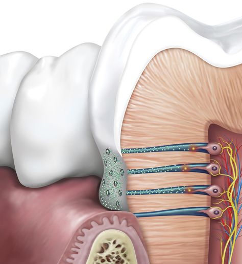 Illustration by Peter Bull showing MOA in a tooth with hypersensitivity for GSK. Explore more work by Peter Bull on the Medical Illustration & Animation Sourcebook online site. #tooth #hypersensitivity #toothsensitivity #dentistry #dentalillustration #patienteducation #illustration #illustrator #dental #sciart Tooth Illustration, Dental Pictures, Kids Dental Health, Dentist Art, Dental Photos, Dental Posts, Dental Videos, Dental Anatomy, Bull Art