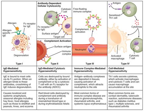 This table describes different types of hypersensitivity. In Type I (IgE-Mediated Hypersensitivity), IgE is bound to mast cells via its Fc portion. When an allergen binds to these antibodies, crosslinking of IgE induces degranulation. Type I causes localized and systemic anaphylaxis, seasonal allergies including hay fever, food allergies such as those to shellfish and peanuts, hives, and eczema. In Type II (IgG-Mediated Hypersensitivity), cells are destroyed by bound antibody, either by activati Fever Food, Build Immunity, Hypersensitivity Reactions, Mcat Study, Medical Laboratory Science, Biology Lessons, Medical School Studying, Human Anatomy And Physiology, Seasonal Allergies