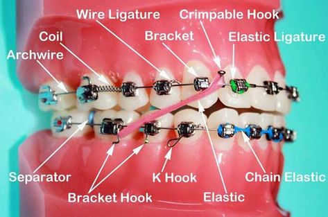 Orthodontist Assistant, Time Diagram, Ceramic Braces, Dental Assistant Study, Dentist Assistant, Dental Hygiene Student, Braces Tips, Dental Hygiene School, Dental Anatomy