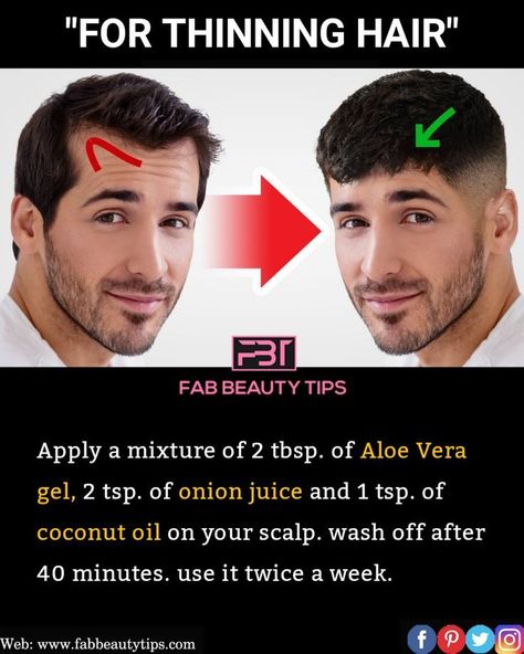 Hair Growth For Men Remedies, Strong And Thick Hair Remedies, Strong Hair Remedies, Hipster Haircuts, Hair Growth Tablets, Hair Growth Oil Recipe, Make Your Hair Grow Faster, Onion Hair, Thicker Stronger Hair