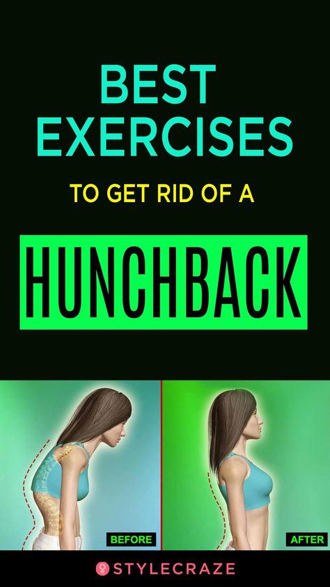 Best Exercises To Get Rid Of A Hunchback #health #fitness Hunchback Posture, Holistic Health Remedies, Posture Exercises, Fitness Ideas, Simple Health, Different Exercises, Best Exercises, Back Exercises, Health And Fitness Tips