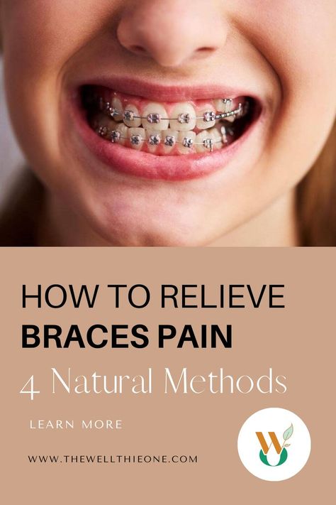 How to Relieve Braces Pain – 4 Natural Methods Getting Braces On, After Braces, Braces Pain, Getting Braces, Natural Pain Relievers, Essential Oils For Pain, Teeth Braces, Tooth Pain, Natural Pain Relief