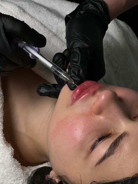 Cosmetic Nursing Aesthetic, Injection Nurse Aesthetic, Cosmetic Nurse Injector Aesthetic, Botox Nurse Aesthetic, Botox Aesthetic Photography, Laser Lipo Before And After, Lip Injections Aesthetic, Dermaplane Aesthetic, Plastic Surgeon Aesthetic