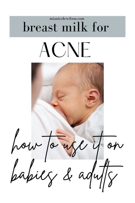 Breast milk for Baby And Adult Acne Breastmilk Uses Remedies, Baby Acne Remedy Breastmilk, Breast Milk Face Mask, Baby Acne Remedy How To Get Rid Of, Breastmilk Facial, Breastmilk Facemask, Uses For Breastmilk, Acne Natural Remedies, Baby Acne Remedy