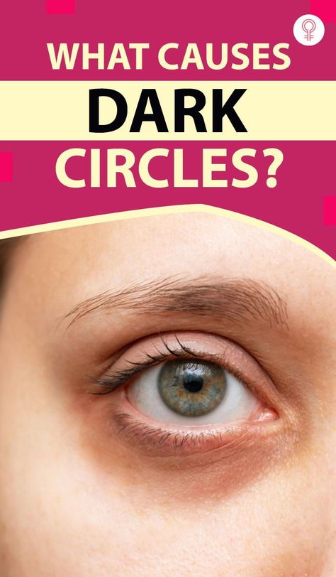 Black Circles Under Eyes Remedies, Darkcircles Skincare, Best Under Eye Cream, Baggy Eyes, Natural Eye Makeup Tutorial, Dark Eye Circles, Soap For Sensitive Skin, Eye Vitamins, Remove Dark Circles