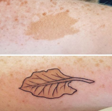 Birthmark Tattoo, Scar Cover Up, Leaf Tattoo, Mark Tattoo, Scar Tattoo, Tattoo Fails, Gothic Tattoo, Bad Tattoos, R Tattoo