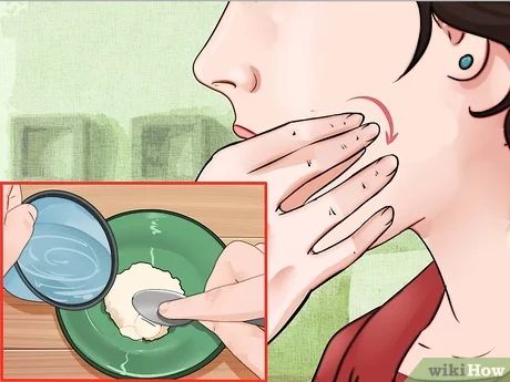 4 Ways to Remove Ingrown Hair on Your Face - wikiHow Ingrown Facial Hair Women, Remove Ingrown Hair, Infected Ingrown Hair, Treat Ingrown Hair, Female Facial Hair, Ingrown Hair Remedies, Swollen Face, Bump Hairstyles, Ingrown Hair Removal