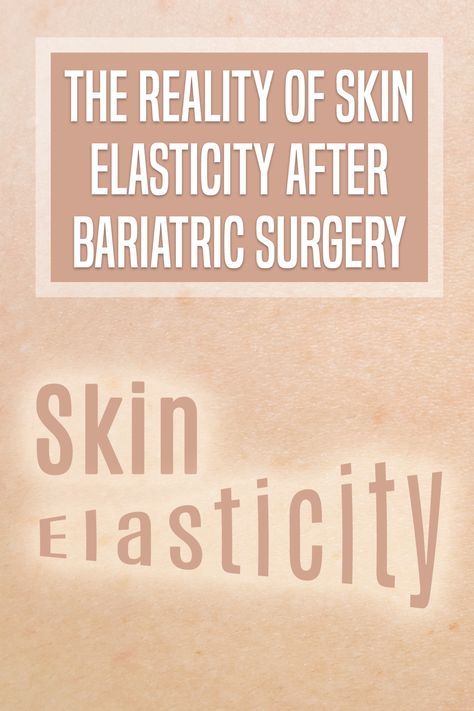 Having plastic surgery after bariatric surgery is a goal for many patients, however, the elasticity of the skin can make it difficult. Learn about skin inflation and deflation after Bariatric Surgery! #plasticsurgery #wls #bariatricsurgery Loose Skin After Bariatric, Exercise After Bariatric, Bariatric Bypass Surgery Before And After, Biatric Surgery Before And After, Bariatric Before And After, Post Bariatric Bypass Surgery Diet, Wls Before And After, Sadi-s Surgery, After Bariatric Sleeve Surgery