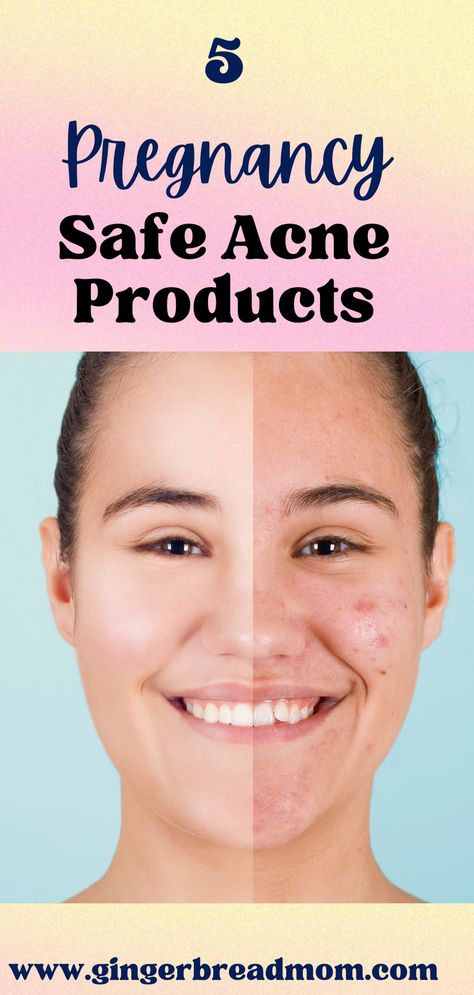 Pregnancy acne is a bummer and not all acne products are pregnancy safe. These 5 acne products are dermatologist approved and considered safe to use during pregnancy. #pregnancysafeacneproducts #pregnancyhack #pregnancyacne Pregnancy Safe Skin Care, Rash On Face, Pregnancy Acne, Acne Body Wash, Acne Medicine, Pregnancy Hacks, Acne Products, Pregnancy Skincare, Bad Acne