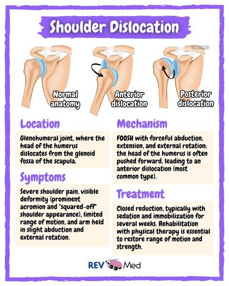 If you can’t tell… we’re Yankees fans over here… 🗽⚾️ Who do you think will win the World Series? PS: We have a list of common FOOSH injuries from hand to shoulder listed below ⤵️ You can never count out a Yankee… believe that. More lessons and high yield notes coming your way. Follow the page 👉🏼 @rev.med FOOSH (Fall On Outstretched Hand) Injuries ✅ Wrist & Hand Scaphoid Fracture *Most common carpal bone fracture, often in young adults  Distal Radius Fractures *Colles Fracture: Dorsal ang... Colles Fracture, Jones Fracture, Scaphoid Fracture, Anatomy For Kids, Ipad Pro Notes, Outstretched Hand, Human Skeleton Anatomy, Shoulder Dislocation, Basic Anatomy