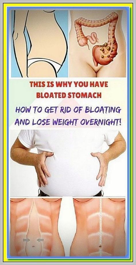 5 Unusual Causes of Bloated Belly and How to Beat It Bloated Stomach, Bloated Belly, How To Eat Less, Reduce Weight, Holistic Health, Womens Health, Belly Fat, Healthy Life, Health Tips