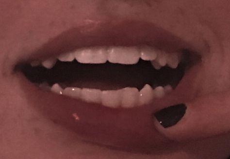 K9 Teeth Human Aesthetic, Teeth Aesthetic Grunge, Shifting Feature Claims, Cute Teeth Aesthetic, Teeth Claims For Dr Sharp, Natural Sharp Teeth, Pretty Teeth With Fangs, Sharp K9 Teeth Human, Dr Scar Claims