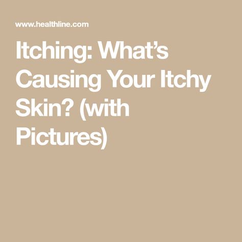 Itching: What’s Causing Your Itchy Skin? (with Pictures) Natural Remedies For Itchy Skin, Itchy Skin Remedies Itch Relief, How To Stop Itching Skin, Itchy Skin Causes, Itchy Legs, Itchy Body, Itchy Skin Remedy, Skin Itching, Itching Skin