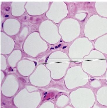 Adipose tissue acts as an insulating layer, helping to reduce heat loss through the skin. It also has a protective function, providing mechanical protection and support around some of the major organs, e.g. kidneys. Adipose tissue is also a means of energy storage. Ancient Egypt Pyramids, Histology Slides, Egypt Pyramids, Microscopic Photography, Connective Tissue, Adipose Tissue, Skin Tissue, Body Anatomy, Ideal Weight