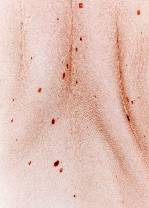 Imperfection Photography, Human Skin Texture, Real Bodies, Body Photography, Texture Photography, Skin To Skin, Skin Clinic, Natural Face, Perfect Skin